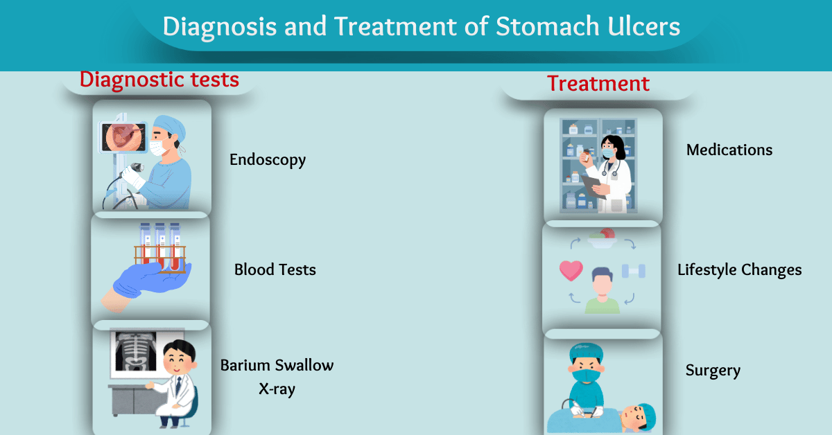 Diagnosis and Treatment of Stomach Ulcer Treatment at Bombay Hospital Mumbai
