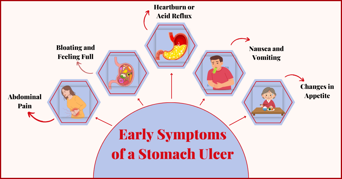 recognise Early Symptoms of a Stomach Ulcer