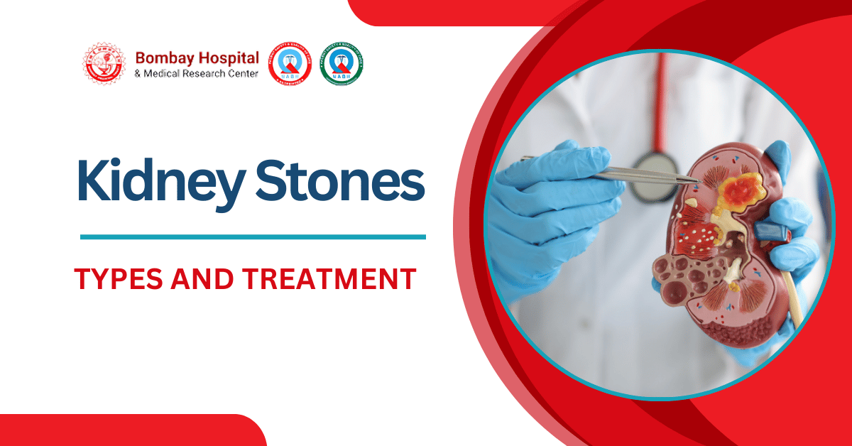 Types of Kidney Stones and How They're Treated