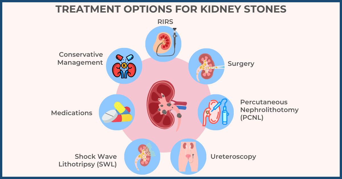 treatment options for kidney stones